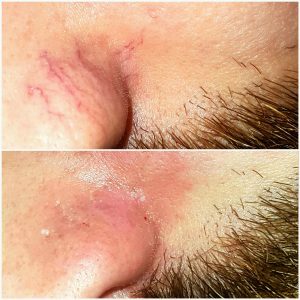 Img 20170119 175353 610300x300