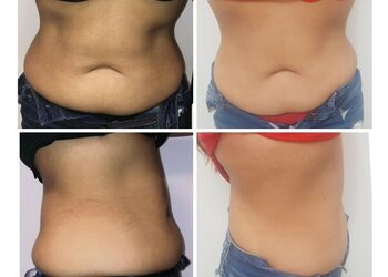 Corporal m 5 sesiones