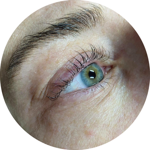Lashliftbotox