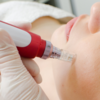 Dermapen spa
