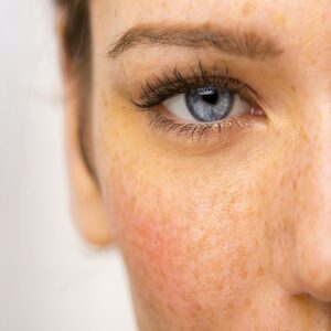 Tratamientoantimanchas