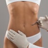 Mesoterapia spa