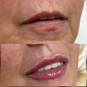 Whatsapp image 20251016 at 18.46.05