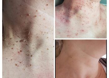 15a39e7c840f497d8b7888bffe107933collage