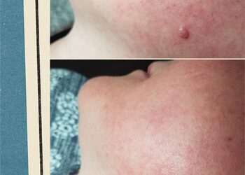 99f0c6e9491d457092c964a137a526facollage