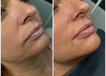 Ezy watermark 30102023 1911198620 original