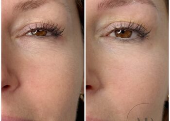 Ezy watermark 13032025 2058178230 original