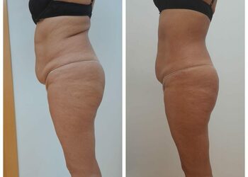 Whatsapp image 20251202 at 15.59.05