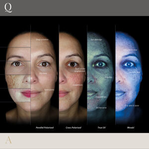 Qna observ520x lightmodes