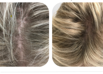 Cellbooster hair antes y despues