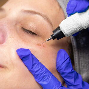 Thelifestylecenterplasmapen5617835x835