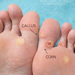 9059d490e797434f8794356b985ab3d1md