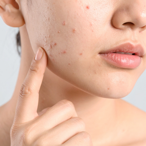 Merry christmas facebook post 4