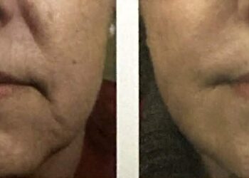 Att.sawzlyhijlw5qux79viugexjxqqhwspaxt3xu2a25t0