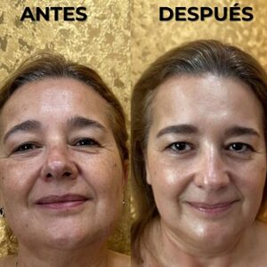 Whatsapp image 20260304 at 11.50.23 am