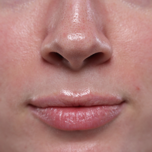 Facial desensibilizante